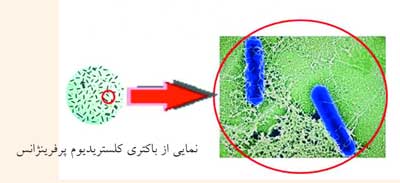  نمایی از باکتری کلستریدیوم پرفرینژانس
